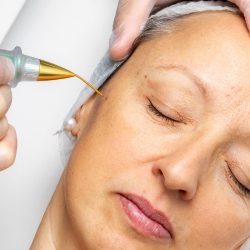 Fibroblast Anti-Wrinkle