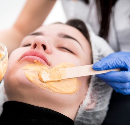 Chemical Peel Richmond