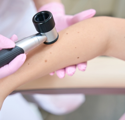 Skin Tag