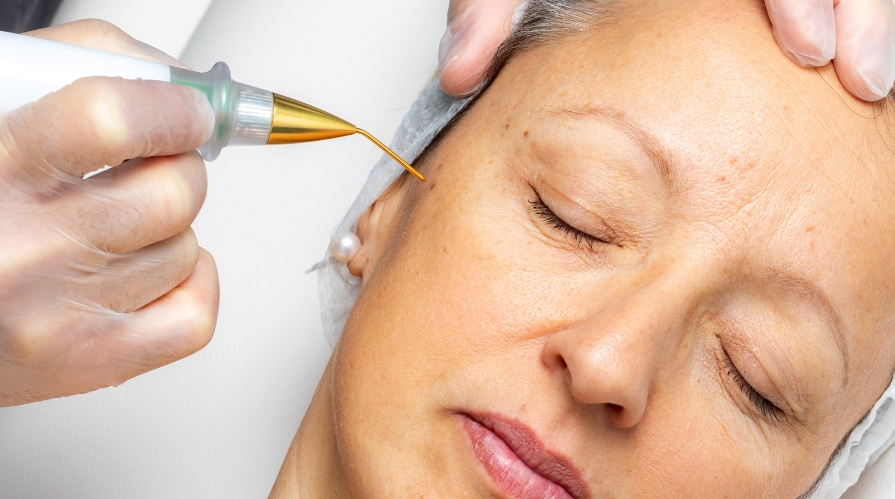 Fibroblast anti-Wrinkle Richmond