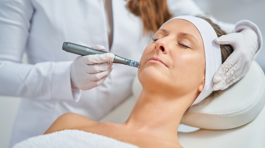 Skin Needling Richmond
