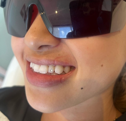 Tooth Gems in Richmond