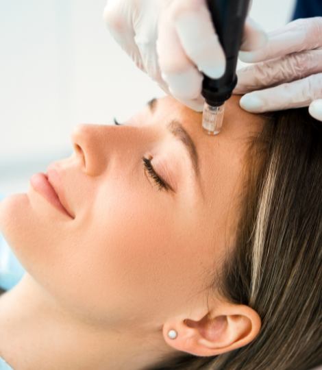 Micro Needling training in Melbourne