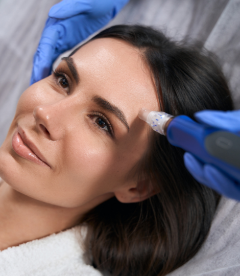 Micro Needling training in Melbourne