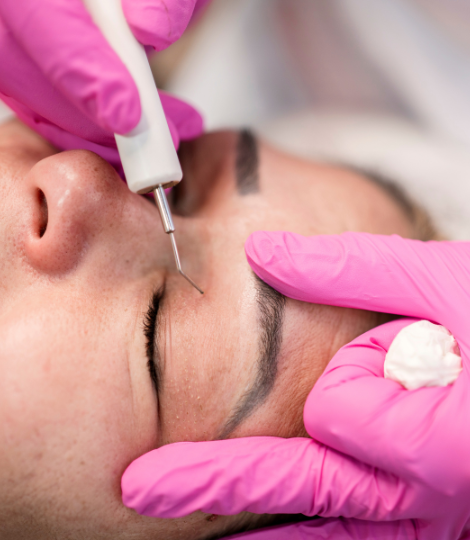 Plasma pen training in Melbourne