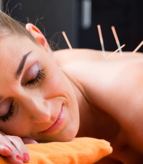 Micro Needling training in Melbourne