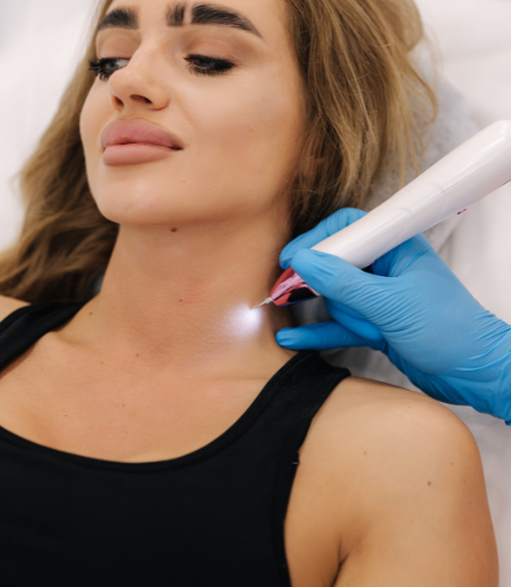 Plasma pen training in Melbourne