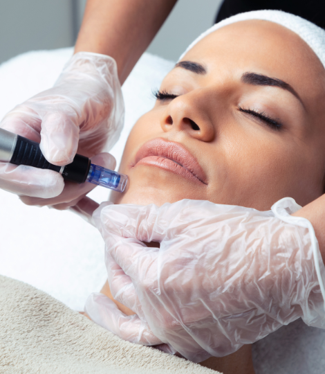 Micro Needling training in Melbourne